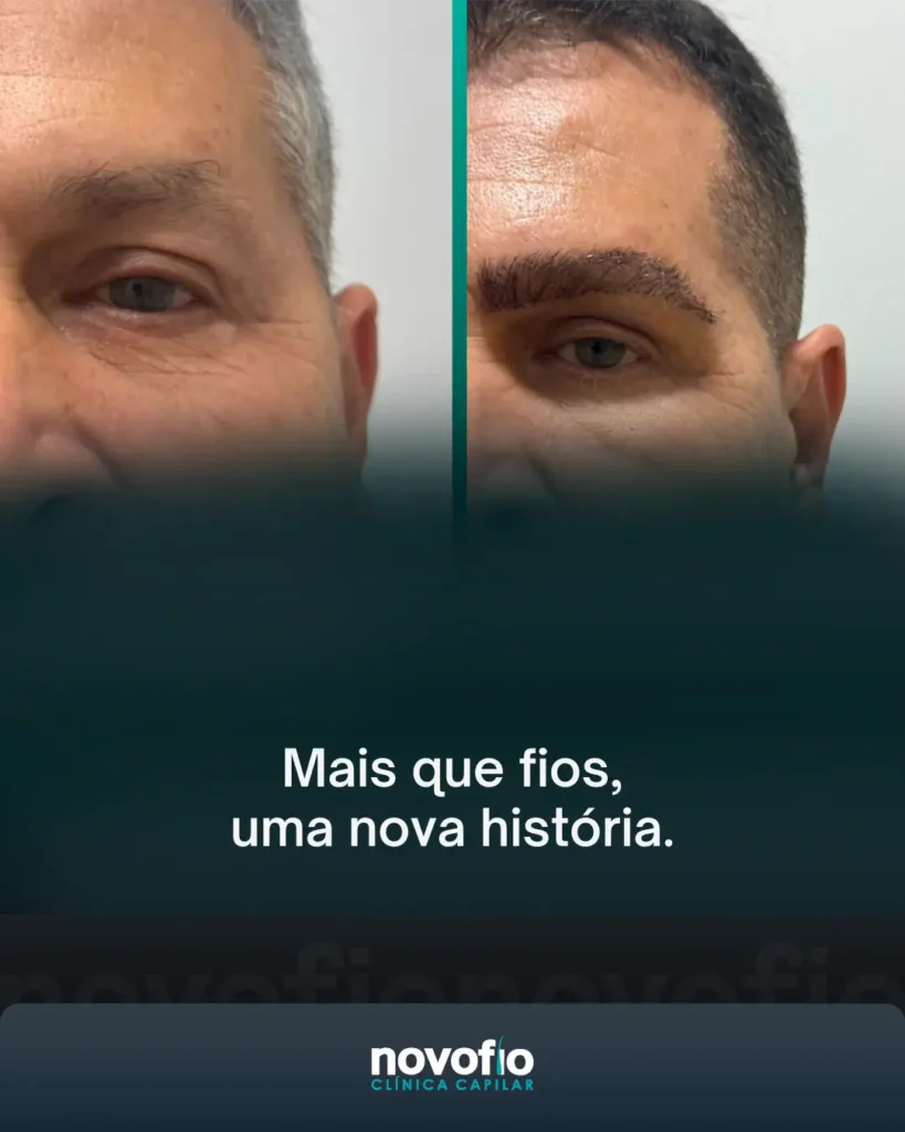 Imagens retangulares - Nutris